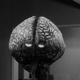 Image for article titled Fifty Shades of Gray Matter: The Most Malevolent Brain Monsters